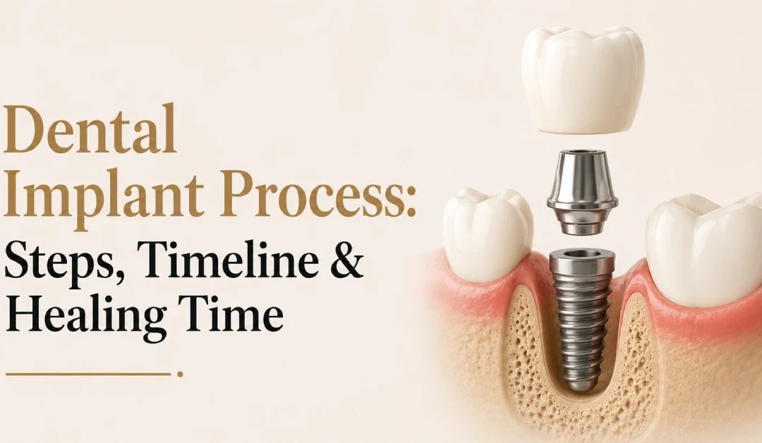 Dental Implant Process: Steps, Timeline & Healing Time